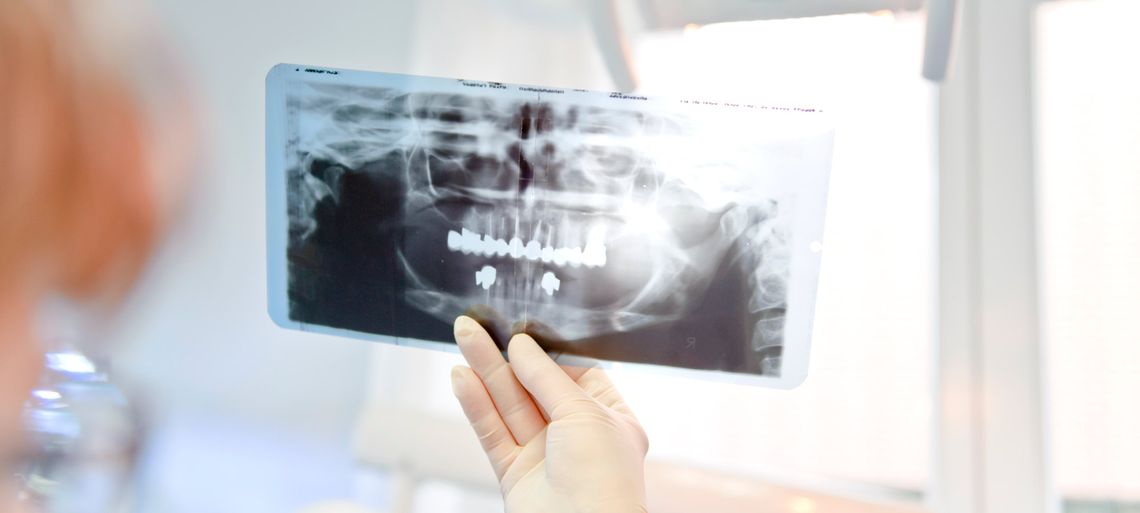 Röntgenbild Zahnarzt